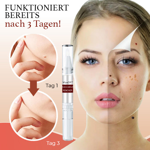 DermaPure Huidlabels Verwijderaar – Pijnloze & Veilige Oplossing voor Een Egale Huid