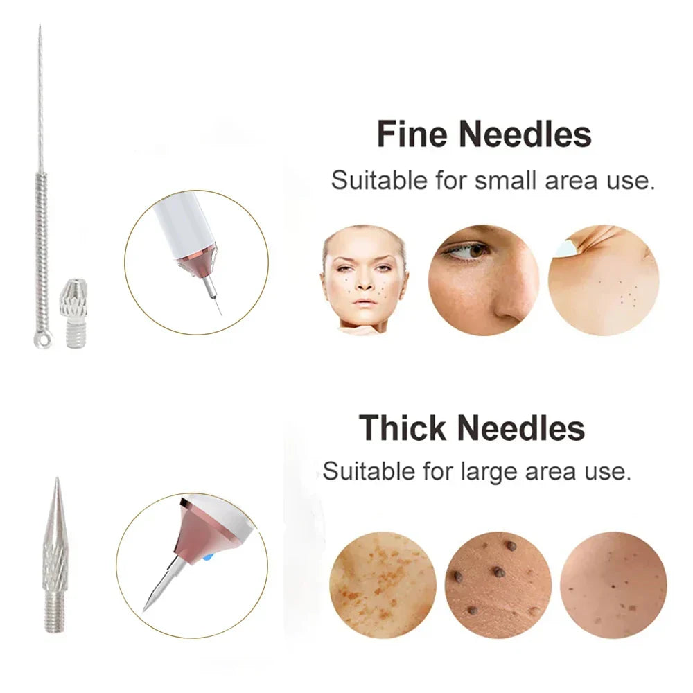 ClearSkin Vlekkenverwijderaar – Pijnloos & Effectief voor Thuis