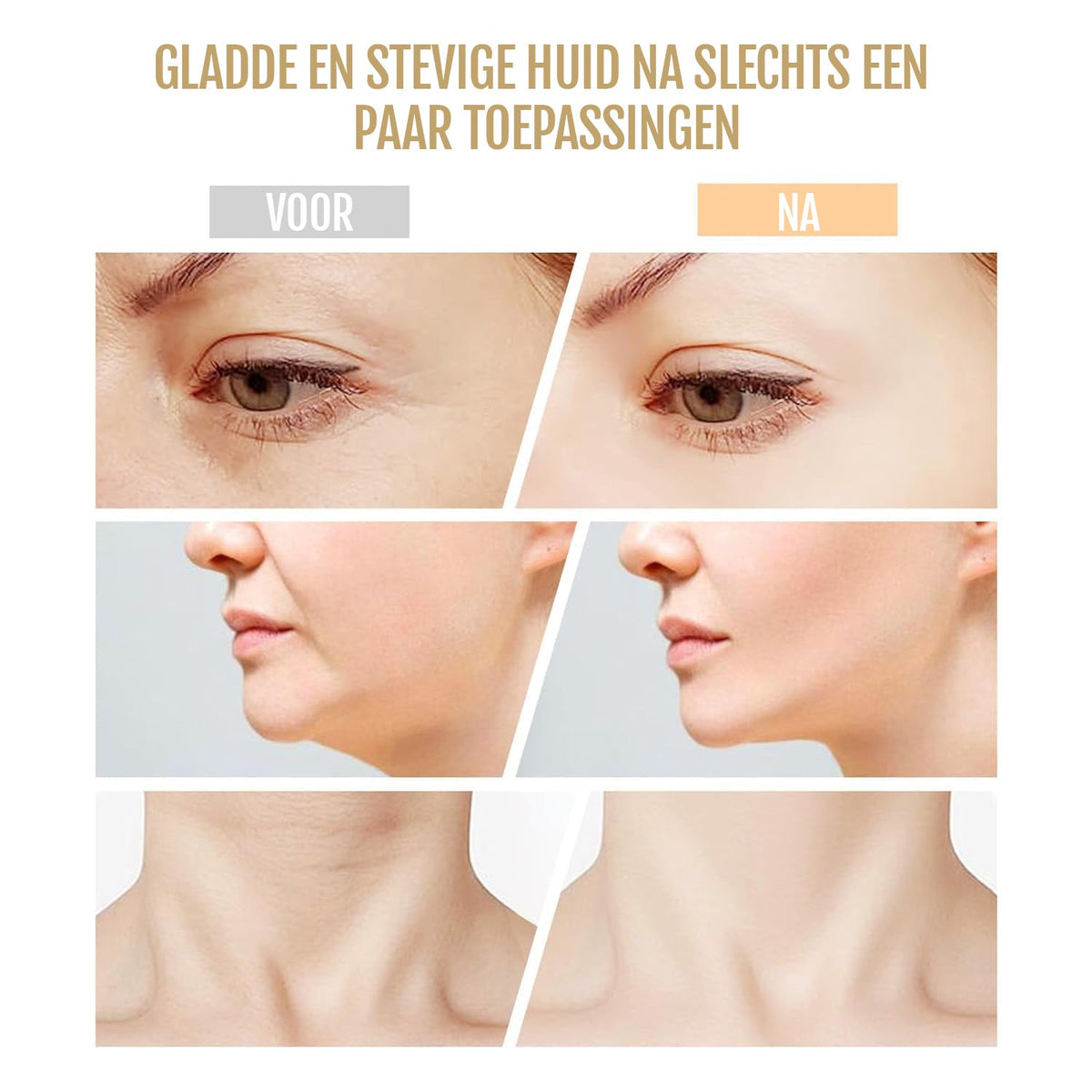 Dermaluxe – 7-in-1 Faceliftapparaat met EMS & Lichttherapie