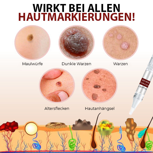 DermaPure Huidlabels Verwijderaar – Pijnloze & Veilige Oplossing voor Een Egale Huid