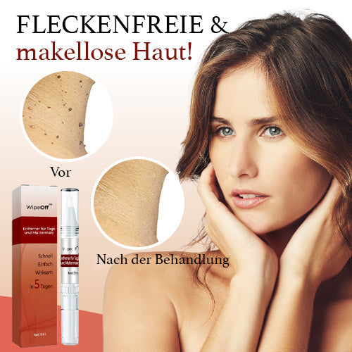 DermaPure Huidlabels Verwijderaar – Pijnloze & Veilige Oplossing voor Een Egale Huid