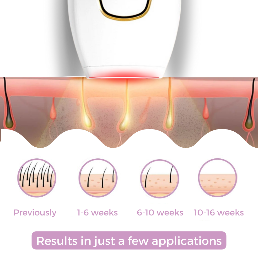 IPL Ontharingsapparaat voor Thuis – Meerdere Standen & Compact Ontwerp