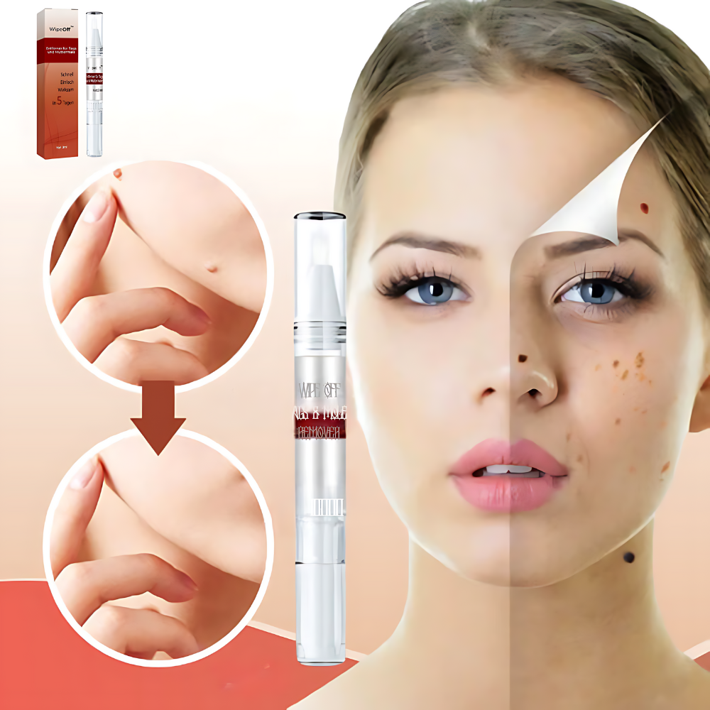 DermaPure Huidlabels Verwijderaar – Pijnloze & Veilige Oplossing voor Een Egale Huid