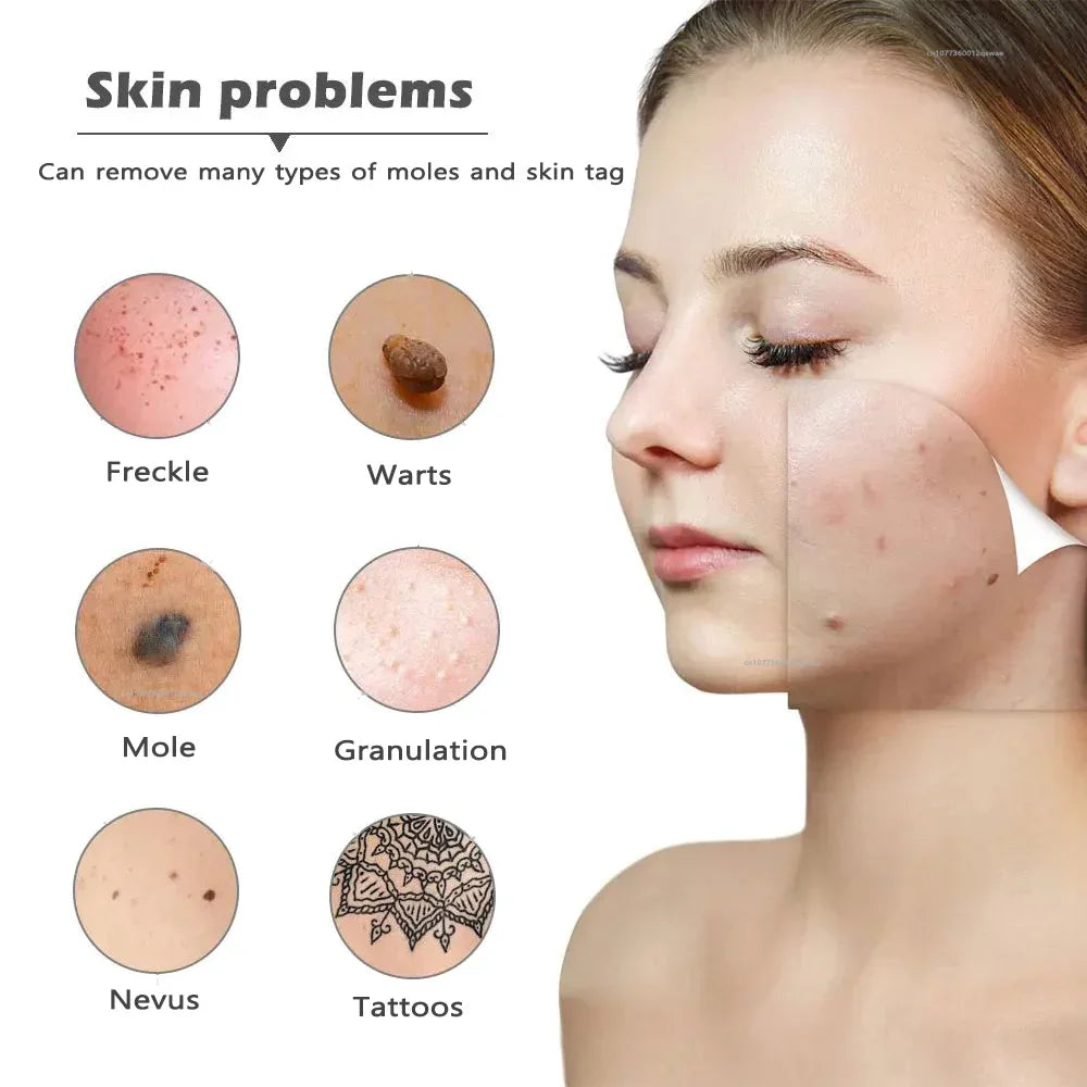 ClearSkin Vlekkenverwijderaar – Pijnloos & Effectief voor Thuis